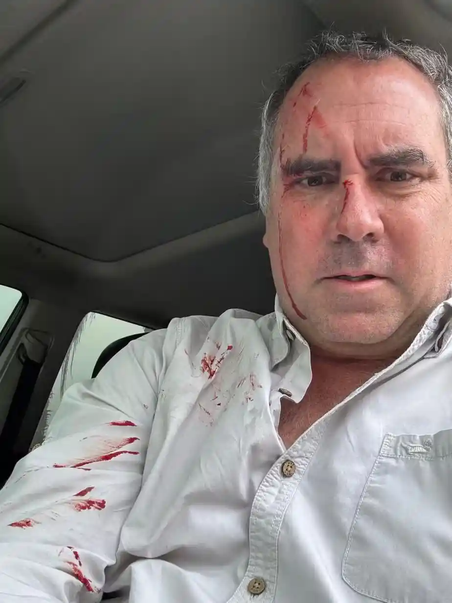 Imagem de Carro de pré-candidato à Presidência do Peru é metralhado