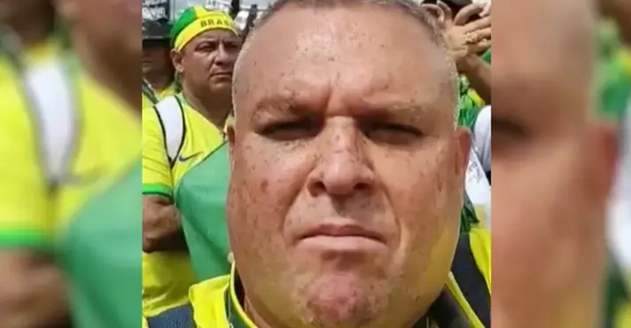 Imagem de Comerciante preso após 8 de janeiro perde parte da visão e enfrenta suspeita de câncer