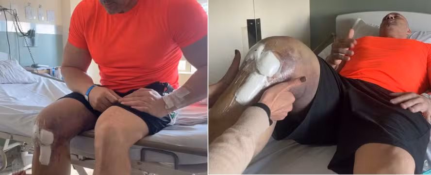 Daniel Silveira faz fisioterapia