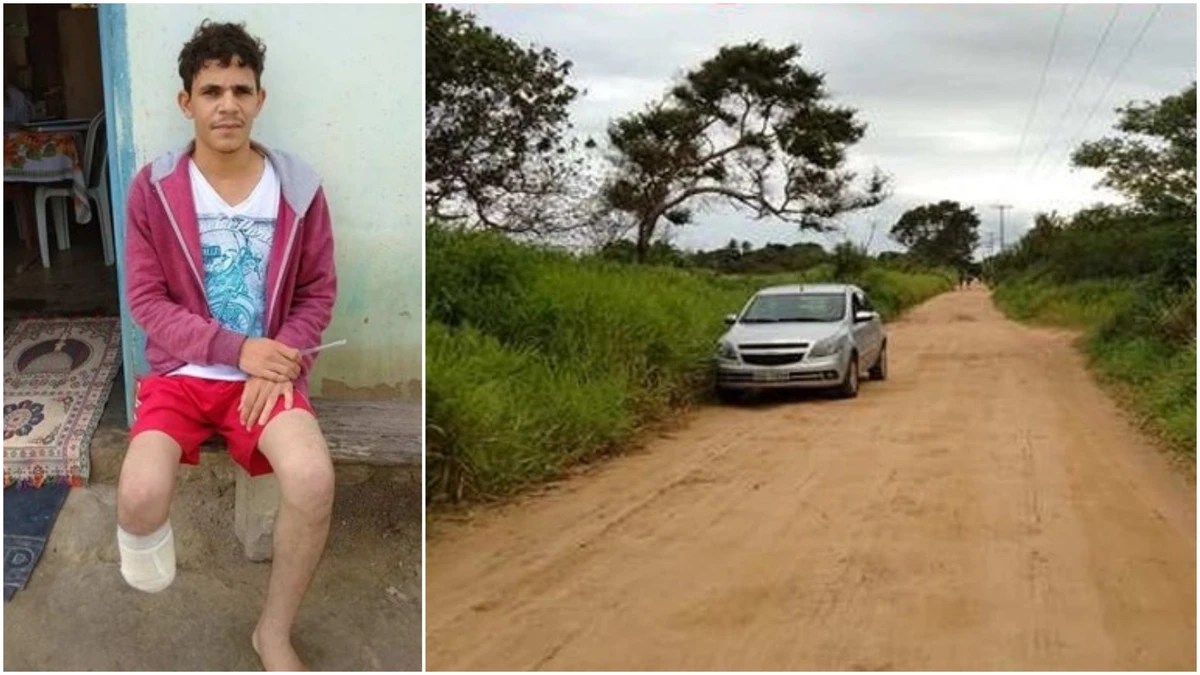 Imagem de Servidor que amputou a própria perna para receber seguro milionário é condenado na Bahia